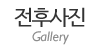 전후사진
